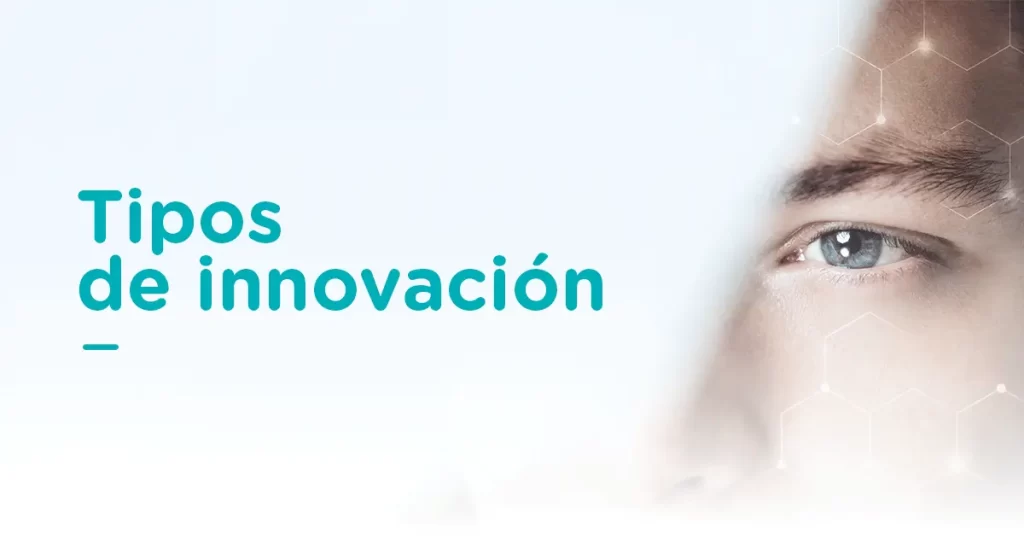 Tipos de innovación que puede implementar una empresa | Ciel